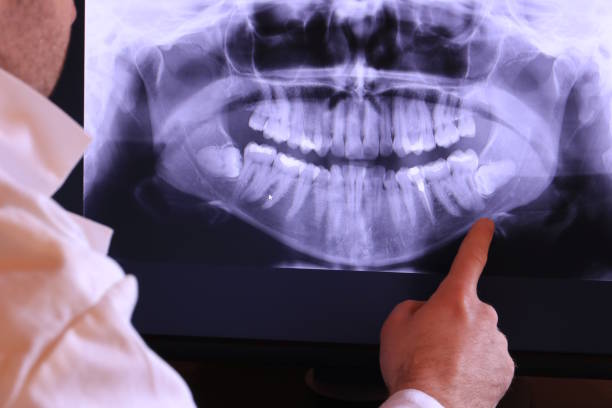 Best Emergency Dental Care for Broken or Chipped Teeth in Woodsboro, MD
