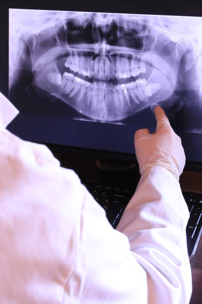Best Emergency Tooth Extraction in Woodsboro, MD
