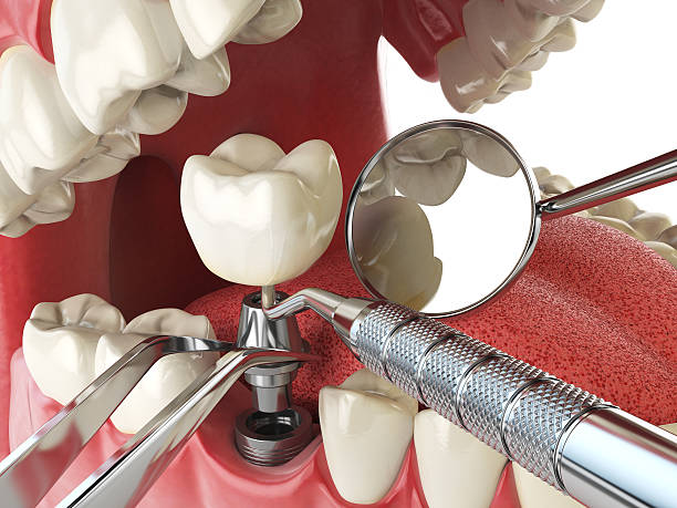 Best Pediatric Emergency Dentist in Woodsboro, MD