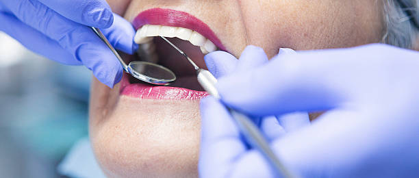 Best Emergency Dental Care for Broken or Chipped Teeth in Woodsboro, MD